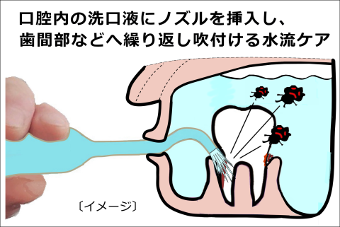 口腔内の洗口液にノズルを挿入し、歯間部などへ繰り返し吹付ける水流ケア